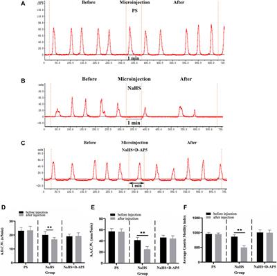 Investigating the L-Glu-NMDA receptor-H2S-NMDA receptor pathway that regulates gastric function in rats’ nucleus ambiguus
